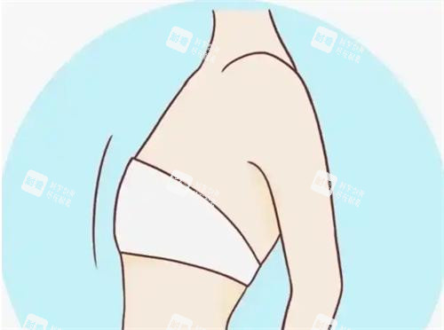 平胸动画展示图 平胸动画展示图