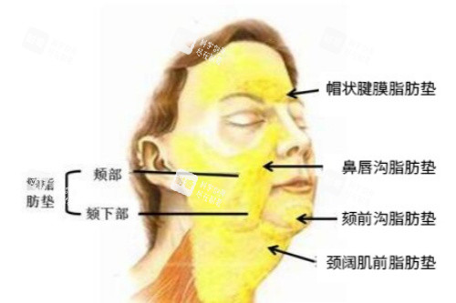 颊脂垫图示 颊脂垫图示