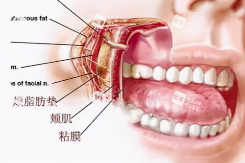 颊脂垫卡通图 颊脂垫卡通图