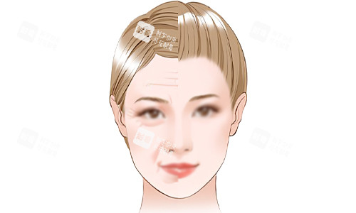 面部抗衰老的意义