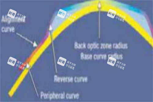 佩戴角膜塑形镜角膜受力示意图