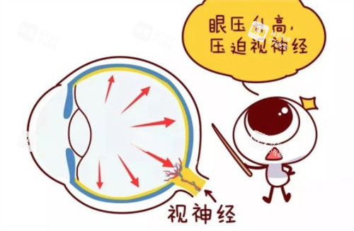 视神经压迫