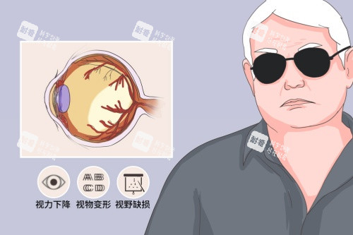 视神经萎缩症状概念图