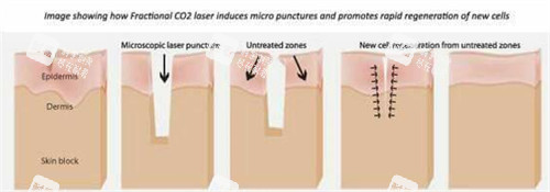 身体疤痕 身体疤痕