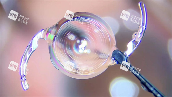 白内障晶体示意图