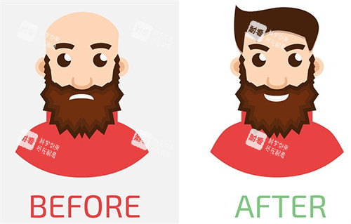 头秃前后种头发对比图 头秃前后种头发对比图