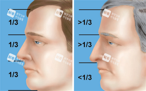 过长的鼻子和正常鼻子矫正对比 过长的鼻子和正常鼻子矫正对比