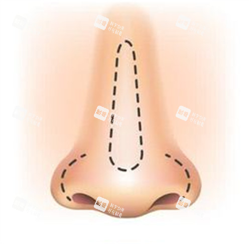 鼻子的卡通绘画图_副本 鼻子的卡通绘画图_副本