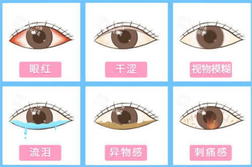 干眼症症状 干眼症症状