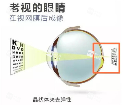 老花眼图片 老花眼图片