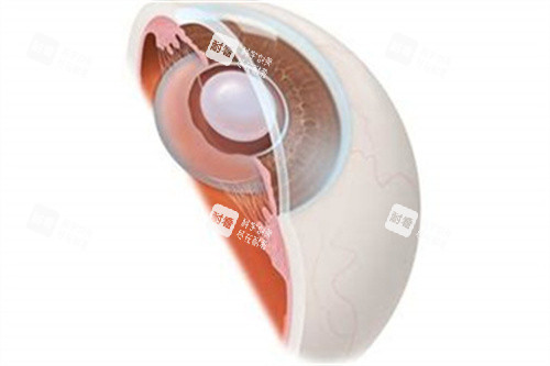 晶体植入示意图 晶体植入示意图