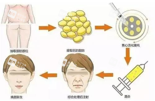 面部填充步骤图