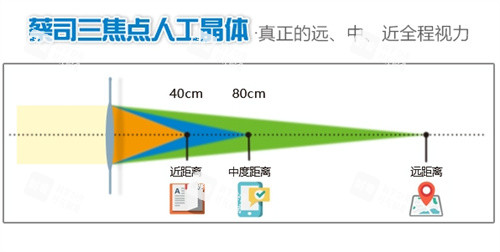 三焦点人工晶体示意图