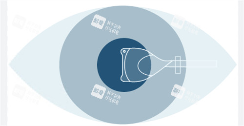 人工晶体植入手术图示