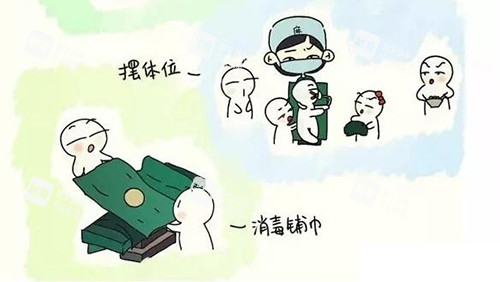 3d生物束带紧缩术手术步骤漫画图