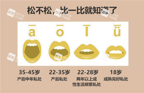 阴道松弛的程度对比