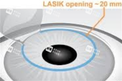 半飞秒制瓣示意图 半飞秒制瓣示意图