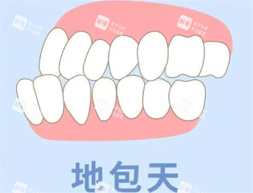 地包天动画展示图