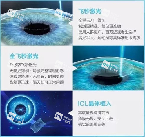 不同近视手术的区别 不同近视手术的区别