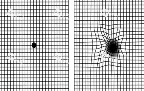 正常视觉和黄斑病变视觉 正常视觉和黄斑病变视觉