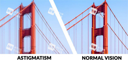 散光眼睛和正常眼睛看东西的区别 散光眼睛和正常眼睛看东西的区别