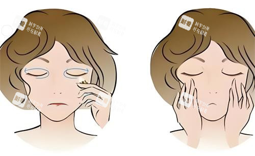 去眼袋前后对比动画图