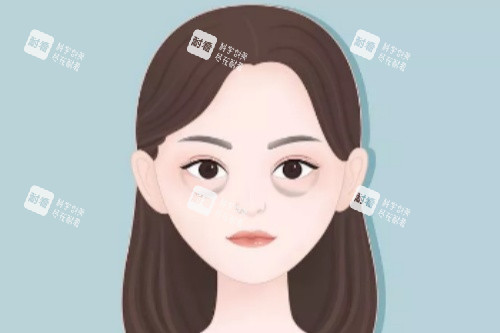 眼袋卡通图展示