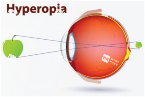 远视