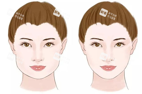 瘦脸卡通对比图