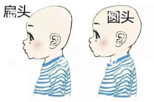 圆头、扁头对比图