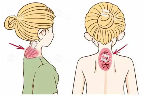 富贵包位置.webp 富贵包位置.webp