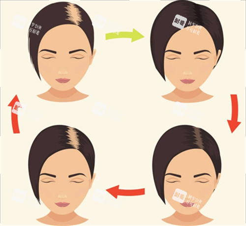 脱发周期素材 脱发周期素材