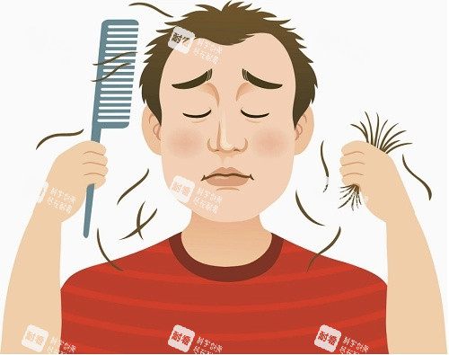 脱发示意图