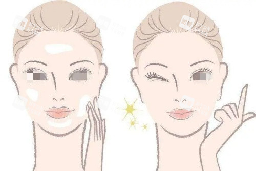 激光美白术后示意图_副本 激光美白术后示意图_副本