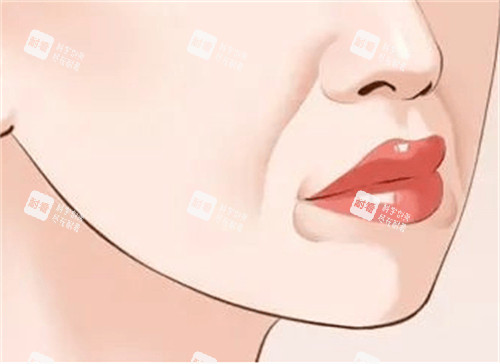 口角囊袋示意图 口角囊袋示意图