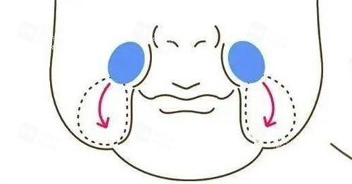 口角囊袋 口角囊袋