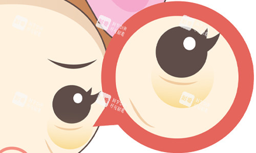 眼袋展示图 眼袋展示图