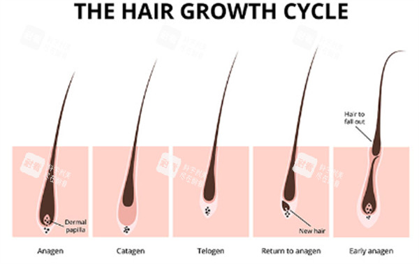 单毛囊移植过程图解