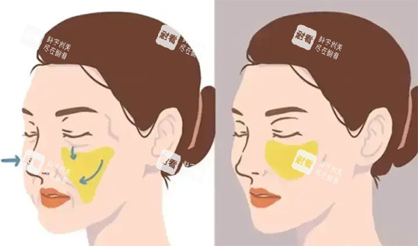 馒化针到底能不能打？正规大白讲解功效作用，适用人群与风险全揭秘