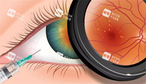 眼睛发炎 眼睛发炎