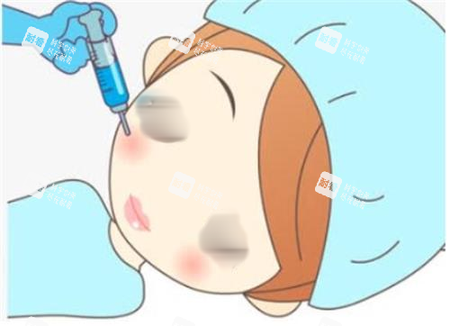 打针瘦脸手术过程图
