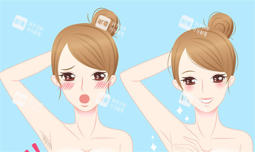 脱毛前后 脱毛前后