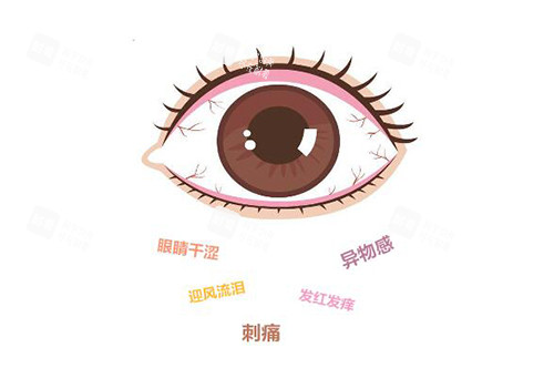 干眼症有哪些表现 干眼症有哪些表现