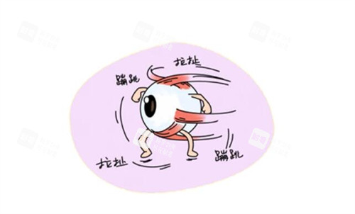 为什么会出现眼球震颤