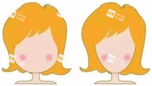 打针瘦脸明显对比图