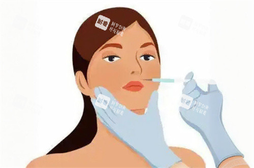 面部注射动画图