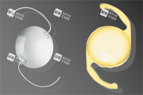 负球差人工晶体 负球差人工晶体