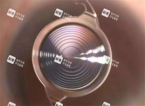 无极变焦人工晶体 无极变焦人工晶体