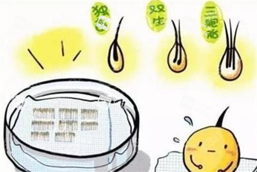 hbw毛囊克隆操作过程图解 hbw毛囊克隆操作过程图解