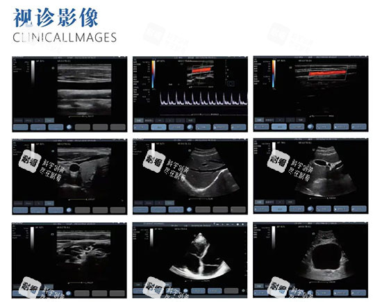 维密金雕影像照片